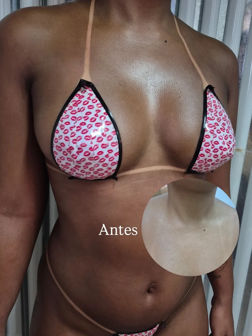 Resultado de bronzeamento na Iluminadas Bronze
